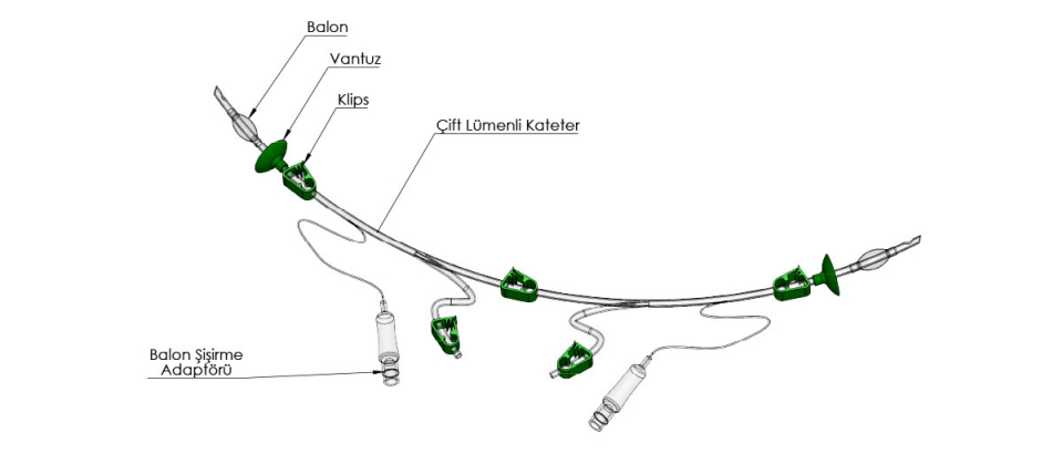 Vessel Bypass Catheter